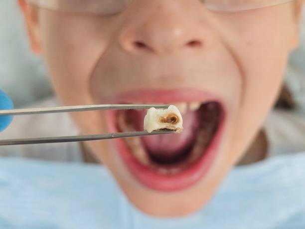 Best Emergency Treatment for Jaw Pain or Injury in Shamokin, PA